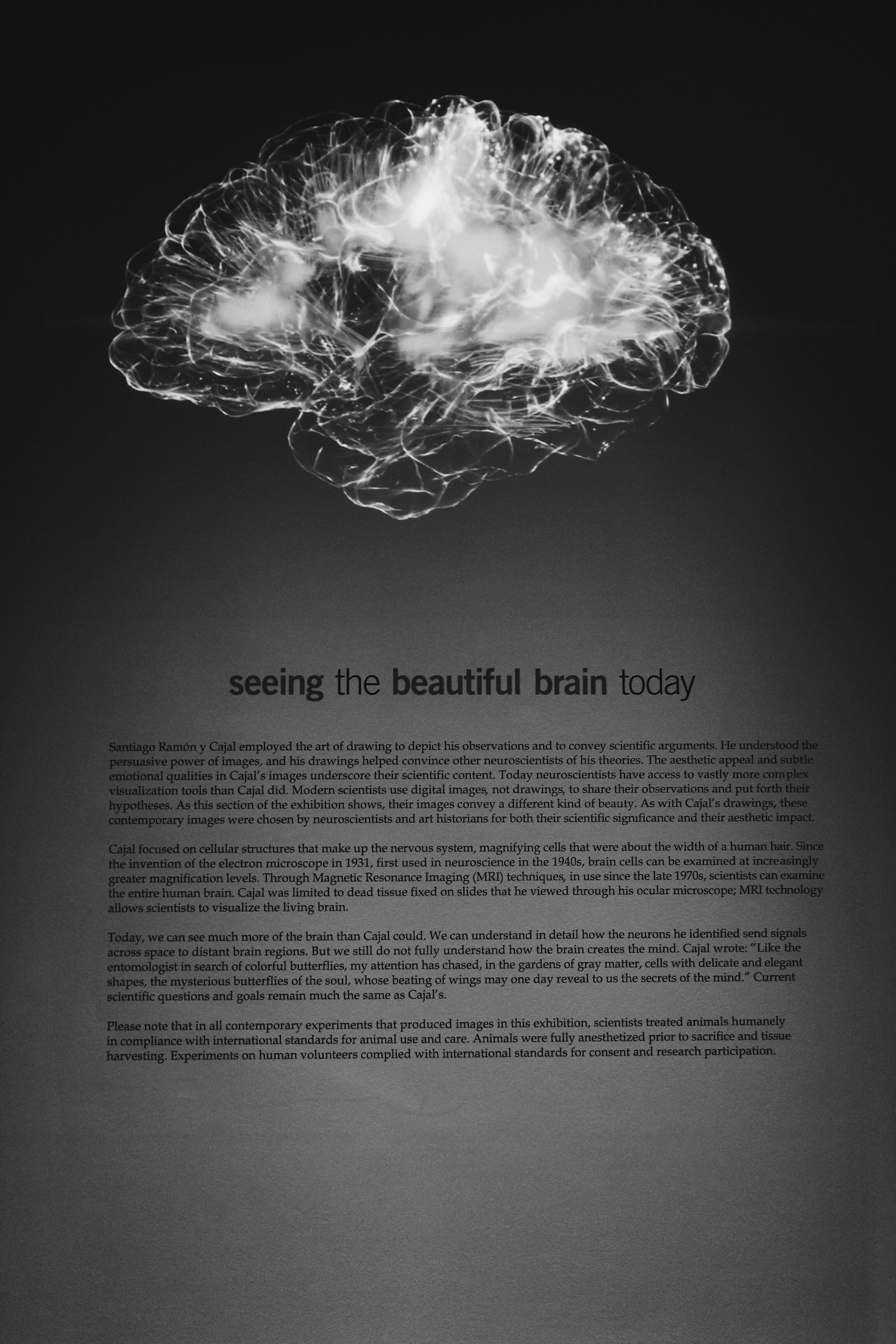 From Labs to Reality: Brain-Tech Success Stories